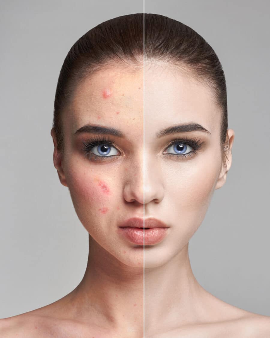 Ретуш шкіри — професійна обробка портретних фото
